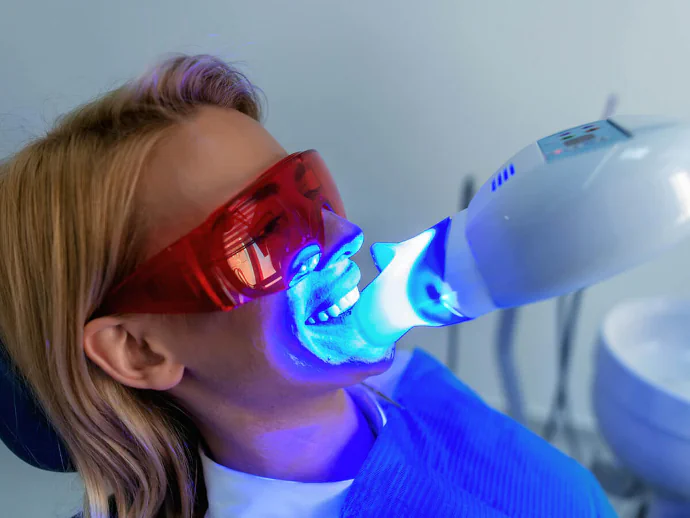 Teeth whitening in the Kansas City area at Kansas City Smiles & Co.