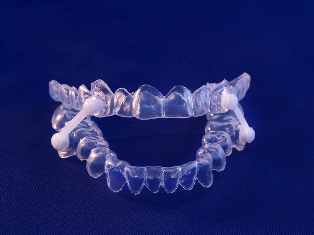 A sleep apnea oral appliance on a blue background