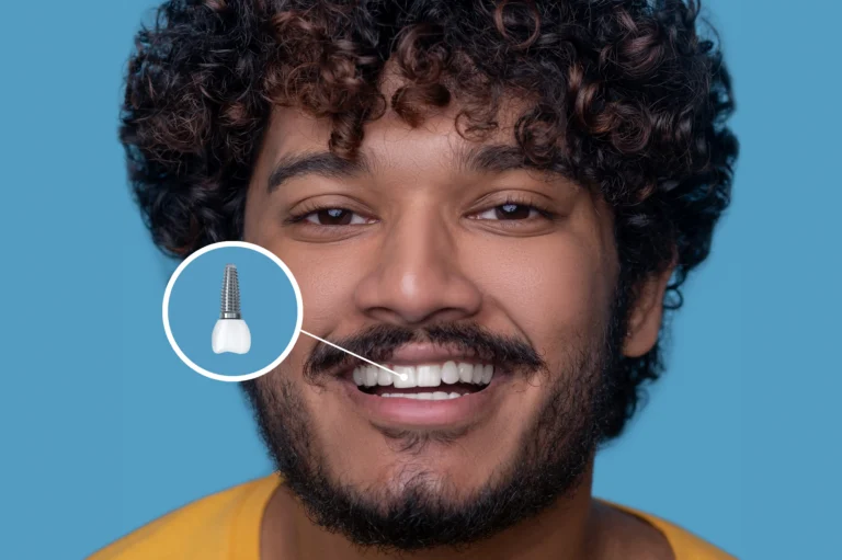 Peri-Implantitis: Signs to Watch For and How to Help Protect Your Dental Implants
